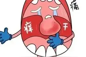 慢性咽炎大解密！16大神药，一文掌握！图片