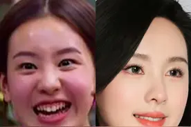 别光把肉毒素当除皱打了，肉毒素的【高阶妙用】！图片