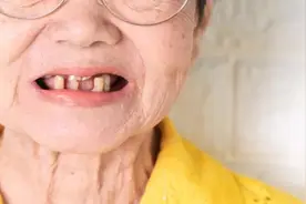 掉牙和寿命有关？60岁后，剩多少颗牙齿算正常？看看...图片