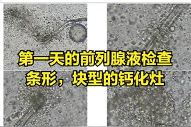 治了10年前列腺炎，他尝试了所有疗法后。。。图片