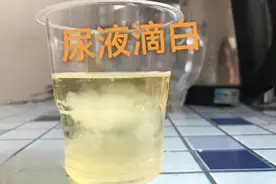 尿滴白，患上前列腺炎的预兆！图片