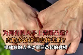 为何有的人手上青筋凸起？青筋多就说明身体差吗？视频封面