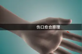 伤口是如何自愈的？带你看伤口愈合全过程，可不要乱扣伤疤视频封面