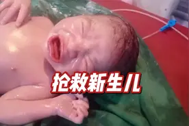刚出生的婴儿就没有呼吸和心跳，医生奋力抢救。视频封面