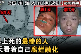 世界上死的最惨的人！被近距离高强度核辐射，在83天内腐烂融化视频封面