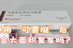 银屑病患者停用“可善挺”后会大面积复发吗？