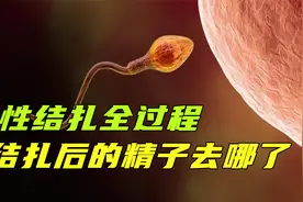 男性结扎全过程，第一个实施计划生育的国家，2年结扎800万男性视频封面