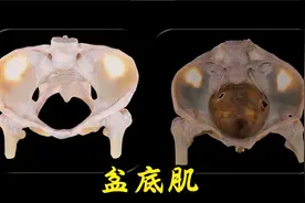 盆底肌：女性骨盆修复的肌视频封面