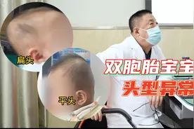 双胞胎宝宝一个头扁一个头平，是怎么回事儿？视频封面