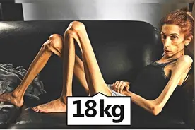 8个世界上最瘦的人，演恐怖片都不用化妆，她们为什么会这么瘦视频封面