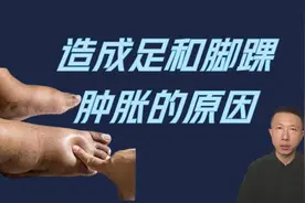 什么原因造成足和脚踝肿胀视频封面