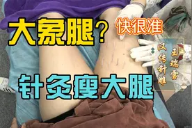 梨形身材-大象腿？针灸瘦大腿、瘦的明显 、不反弹视频封面