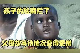 孩子的脸腐烂了，父母不仅没有带他去看医生，还等待情况变得更糟视频封面