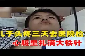 学霸儿子头疼三天，父母带到医院惊动全国专家，心脏里扎满大铁针视频封面