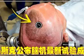 马斯克公布了脑机人机人体试验的最新结果，震惊整个医学界视频封面