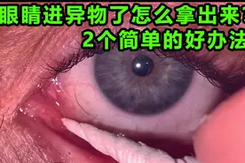 眼睛进异物了怎么办？有两个简单的方法视频封面