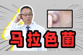 它是多种皮肤病的罪魁祸首，几乎遍布人体皮肤表面，如何去应对？视频封面