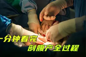 剖7层缝7层，剖腹产到底有多疼？一份钟看完剖腹产全过程视频封面
