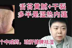 舌苔黄腻+干裂，多半是湿热内蕴，一个中成药，疏肝健脾祛湿视频封面