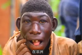 非洲猴孩艾力，长相返祖以水果为食，一周能跑230公里视频封面