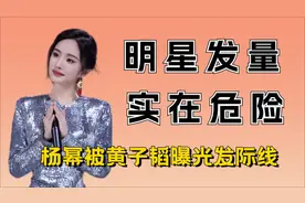 原来明星竟也“秃头” ，杨幂发际线暴露，黄晓明仿佛老了十岁视频封面