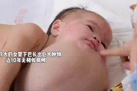 20岁女孩产下畸形胎儿，医生建议放弃，奶奶一番话改变了孩子命运