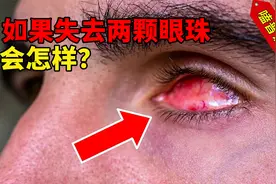 如果你失去眼球，看到的世界是什么样？失去其他器官还能活多久？视频封面