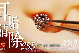 沉浸式大头钉耳垢清除模拟触发音轻松解压快速入睡@DOU+小助手视频封面