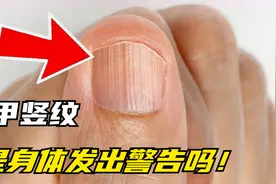指甲上出现的竖纹，是我们身体发出的警告吗？答案在这里。视频封面