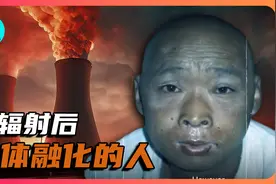 被核辐射后！亲眼目睹身体慢慢融化的人，日本东海村JCO临界事故视频封面