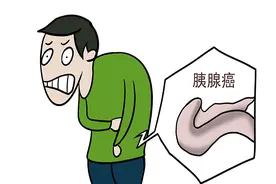 别把“癌王”胰腺癌认错，和胃病区别很大，提醒5类人群注意筛查图片