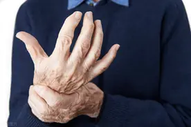 吵架时手抖是帕金森的信号？药师：未必！或者这几种疾病在作怪图片