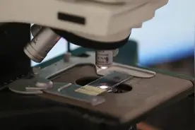 病理学检查是癌症诊断治疗的金标准图片