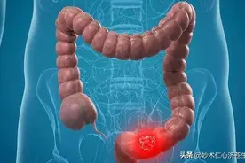 大便干结，一粒一粒的？中医只用一方，润肠通便，增强肠道活力！图片
