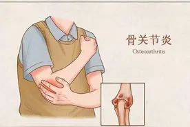 手关节痛是痛风嘛？不一定，也有可能是这四种疾病，你是哪一种？图片