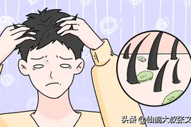 头皮里面居然会有螨虫？该怎么办才好？图片