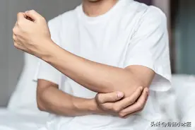 肘关节脱位图片