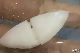 一个小伙子的自述：3年前做了假体下巴，现在很后悔图片