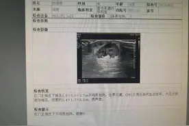 肛门附近长“痘”，女子拒绝就医！医生：小心痛不欲生图片