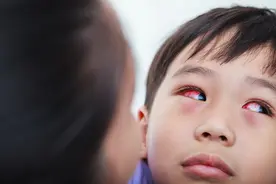“左眼跳财，右眼跳灾”？提醒：眼皮不停跳，可能是身体出问题了图片