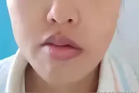 当孕期遇见面瘫图片