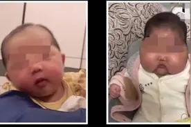 5月大婴儿变“大头娃娃”？警惕！家里有这种宝宝面霜的，请停用图片