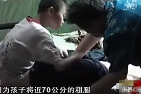 真实故事：河南10岁“象腿”男孩，名医束手无策，被整容医生治好图片