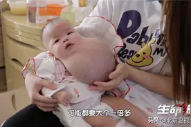 00后孕妈产检发现孩子发育异常，舍弃还是保留？女婴曾面临三次生死选择图片
