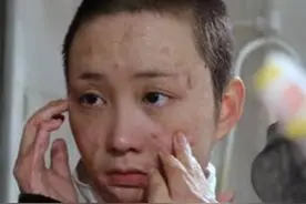 周岩：16岁被官二代焚烧毁容，如今涅槃重生，称永远感激爱心人士图片