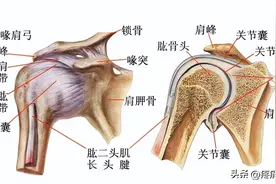 反复肩部疼痛，可能是冈上肌腱炎图片