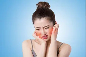 脂溢性皮炎的人在冬季如何护肤？图片