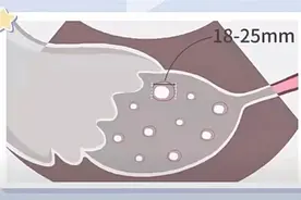 吃什么可以拥有优质的卵子生一个健康宝宝图片