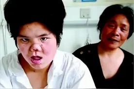88年农民捡到坑面女婴，哥哥做苦力为妹妹整容，变美后她嫁给哥哥图片