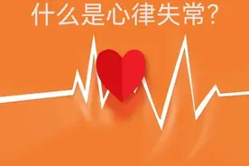 什么是心律失常？图片